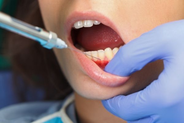 Greffe de gencive - AlloDerm - Centre dentaire Stephane Girard a St-Jerome (1)