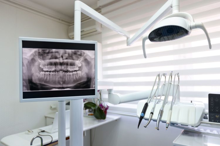 nettoyage dentaire annuel - Centre dentaire Stephane Girard